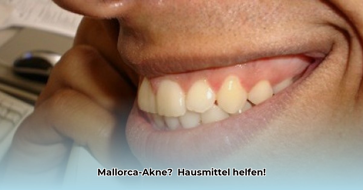 mallorca-akne-hausmittel
